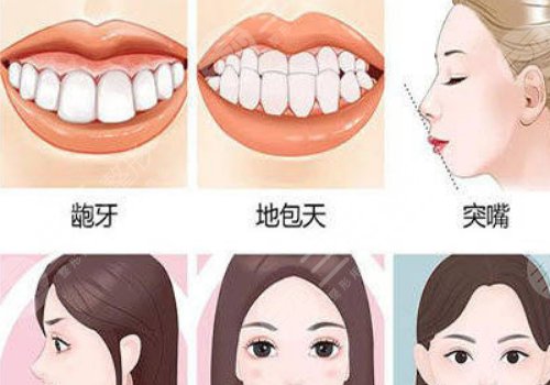 何晋龙正颌真人案例投稿