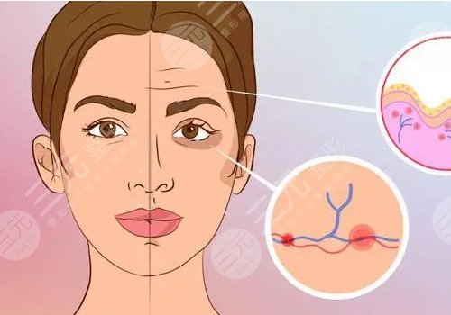 肤莱美和肤丽美的区别是什么？