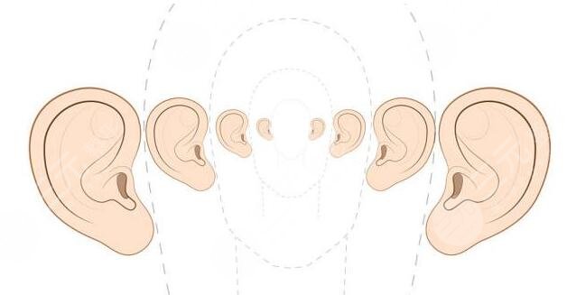 【新】   耳基底提升能保持多久