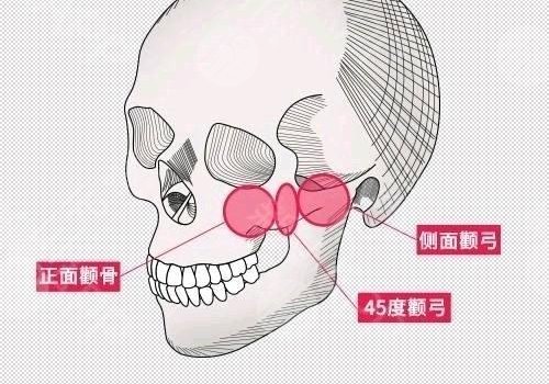 磨骨有什么危害和后遗症