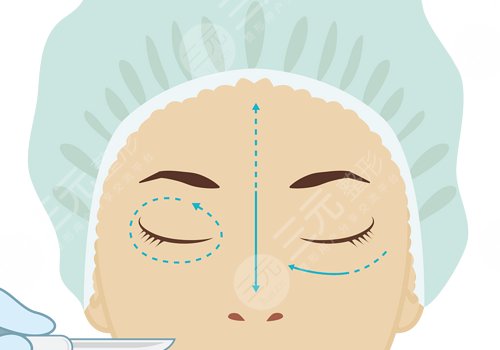 切双眼皮多久能恢复自然？