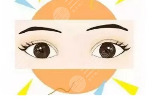 贵阳美贝尔徐威做眼睛好吗?