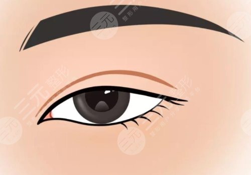 贵阳美贝尔徐威做眼睛好吗?