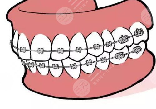 牙齿矫正什么年龄段好？