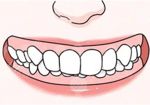 牙齿矫正什么年龄段好？