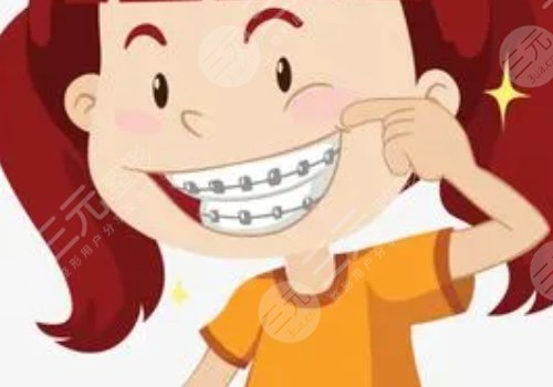 牙齿矫正用隐形牙套还是钢丝牙套好？