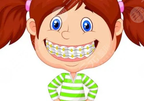 牙齿矫正用隐形牙套还是钢丝牙套好？