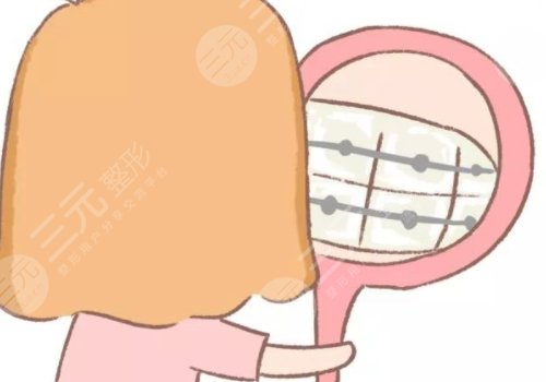 牙齿矫正用隐形牙套还是钢丝牙套好？