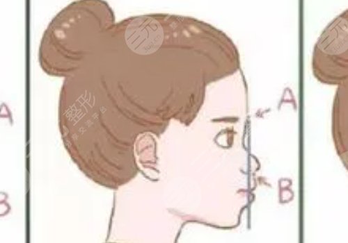 嘴凸是怎么造成的?