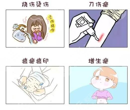 像素激光祛疤多少钱?