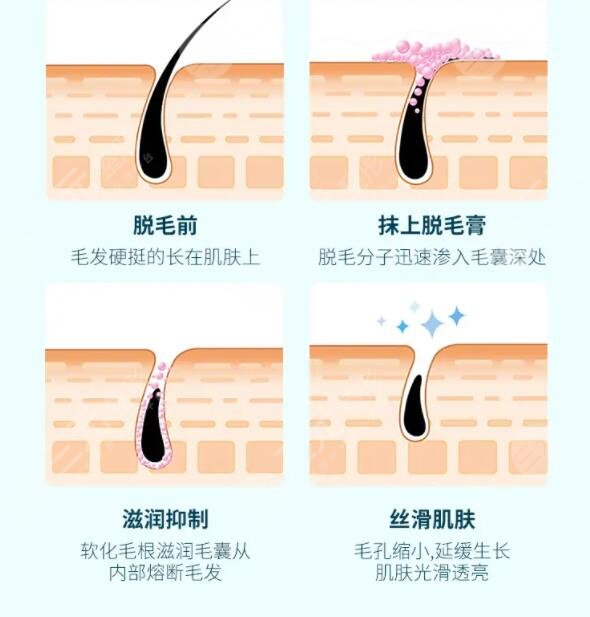 veet脱毛膏注意事项有哪些?