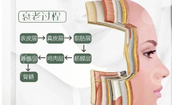 分层抗衰
