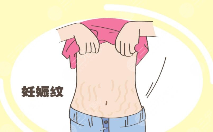 橄榄油去妊娠纹有副作用吗?