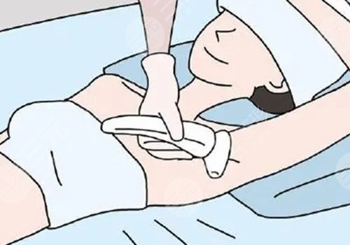 脱毛仪哪个牌子效果比较好？