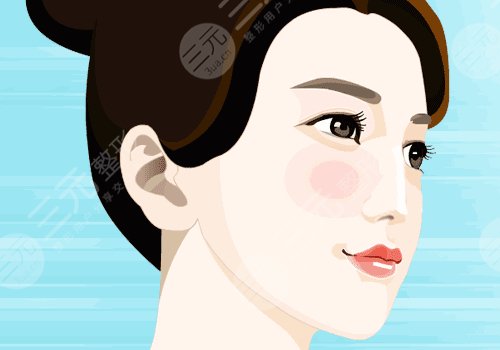 玻尿酸隆鼻子可以维持多久？