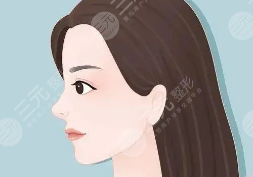 玻尿酸隆鼻子可以维持多久？