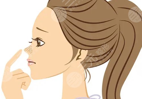 玻尿酸隆鼻子可以维持多久？