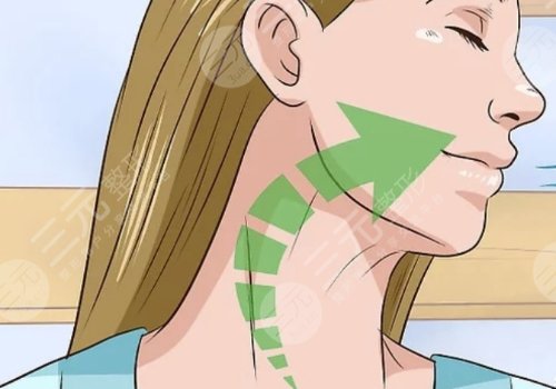 颈纹特别深怎么去除？