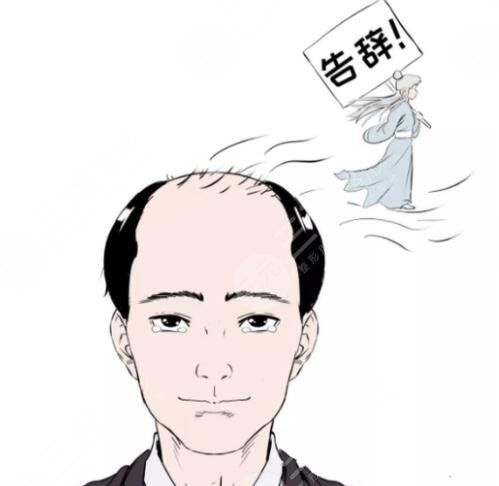 防脱洗发水有哪些?可以改良脱发吗?