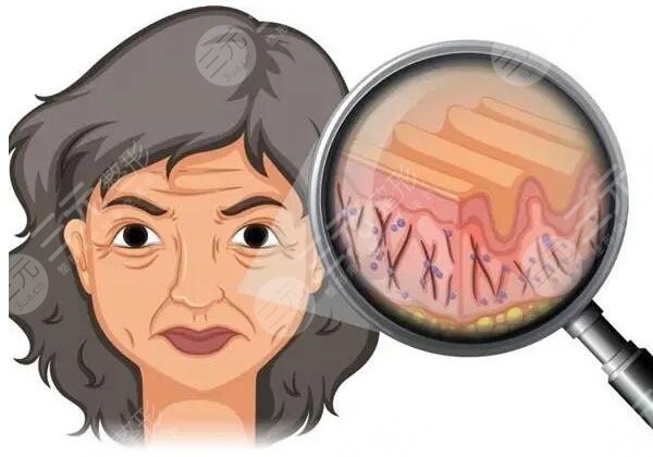 脸部皱纹怎么去除好呢?