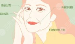轮廓固定做什么项目?医美抗衰新潮流,深入了解! 轮廓固定做什么项目?医美抗衰新潮流,深入了解!