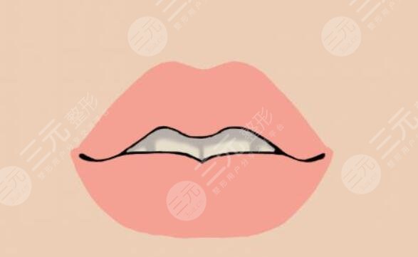口角提升