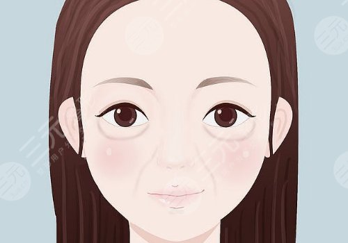 激光去眼袋能保持多久?多少钱?
