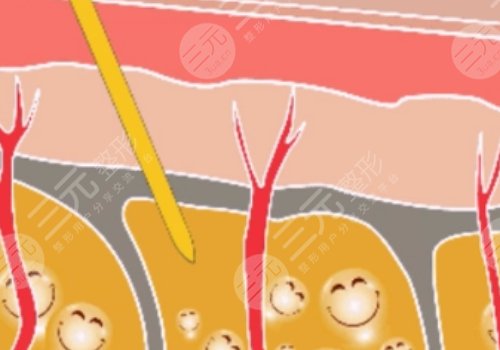 福州海峡医疗美容整形医院怎么样?