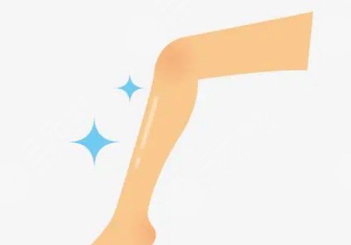 瘦小腿的方法有哪些?