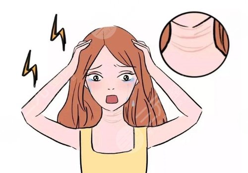 颈纹是什么原因造成的?