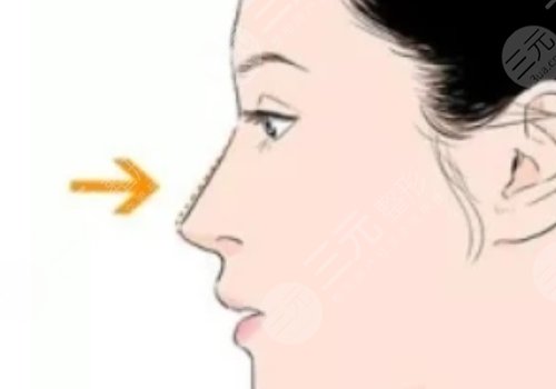 天津伊美尔熊斌怎么样?