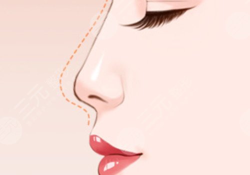 天津伊美尔熊斌怎么样?