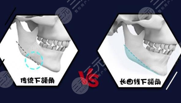 河东镐医生擅长项目科普