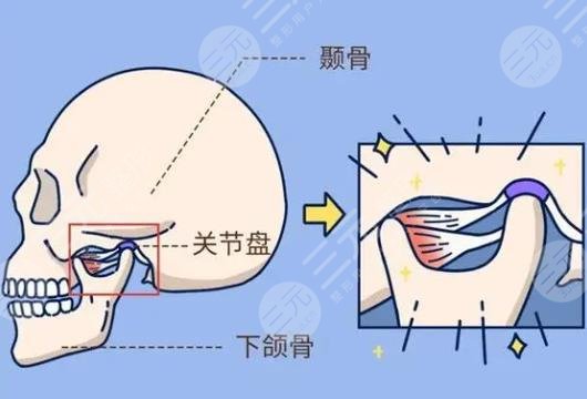 下颌角