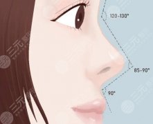 北京整鼻子多少钱？北京隆鼻收费升级更新，本地网友认可！