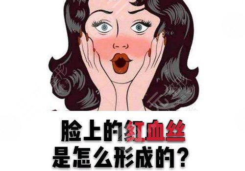 脸上长红血丝怎么去掉？