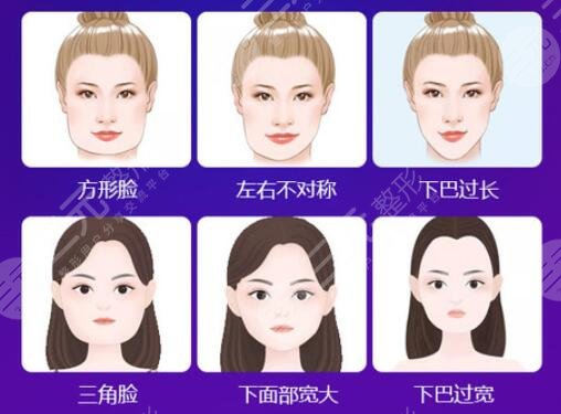 上海磨骨黄敬夏医生擅长项目介绍