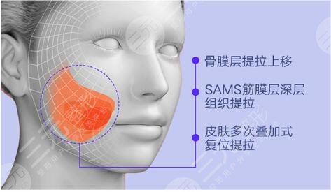 黄敬夏医生擅长项目科普