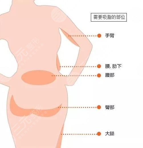 腿部吸脂手术有什么危害吗?
