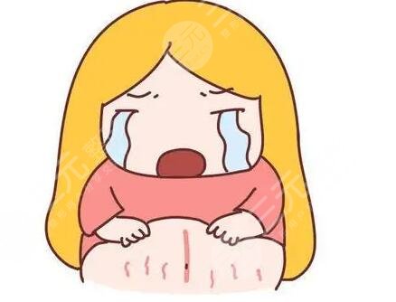 橄榄油预防妊娠纹有效吗?