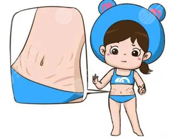 橄榄油预防妊娠纹有效吗?