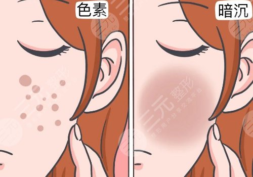 肤色暗沉的原因有哪些?
