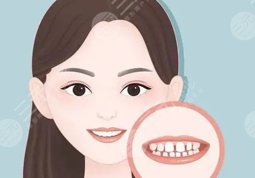 冷光美白牙齿对牙齿有什么伤害？