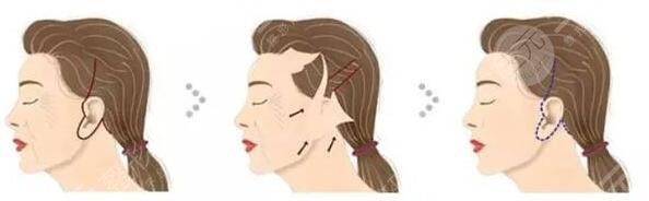 八大处整形医院开展项目