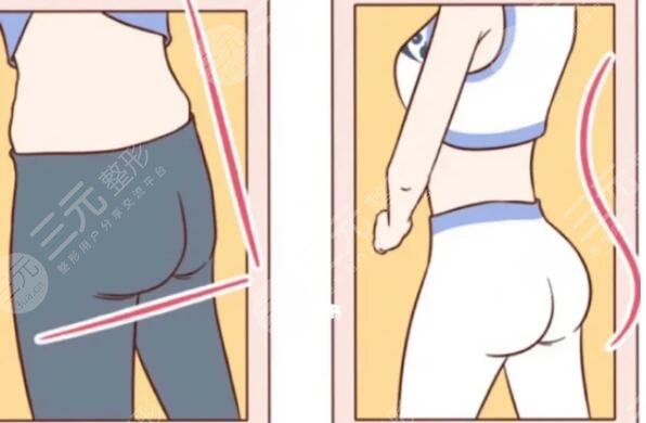 减肥后会反弹吗?