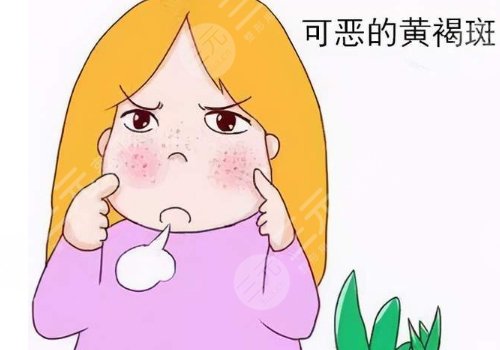 怎样去除面部黄褐斑有效？