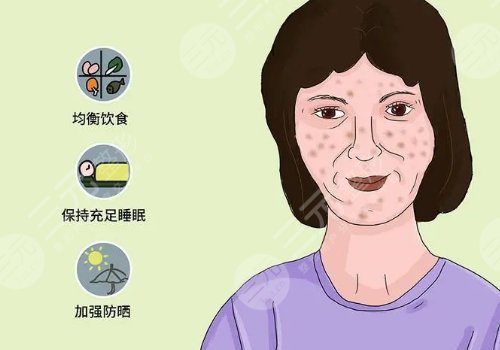 怎样去除面部黄褐斑有效？