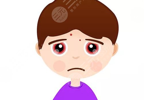 脸上有痘印怎么办才能去掉呢？