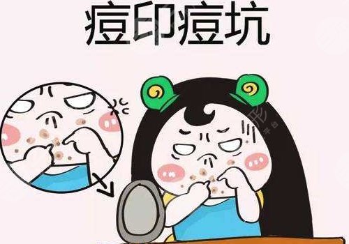 脸上有痘印怎么办才能去掉呢？