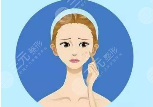 激光去斑一般多少钱？做几次？